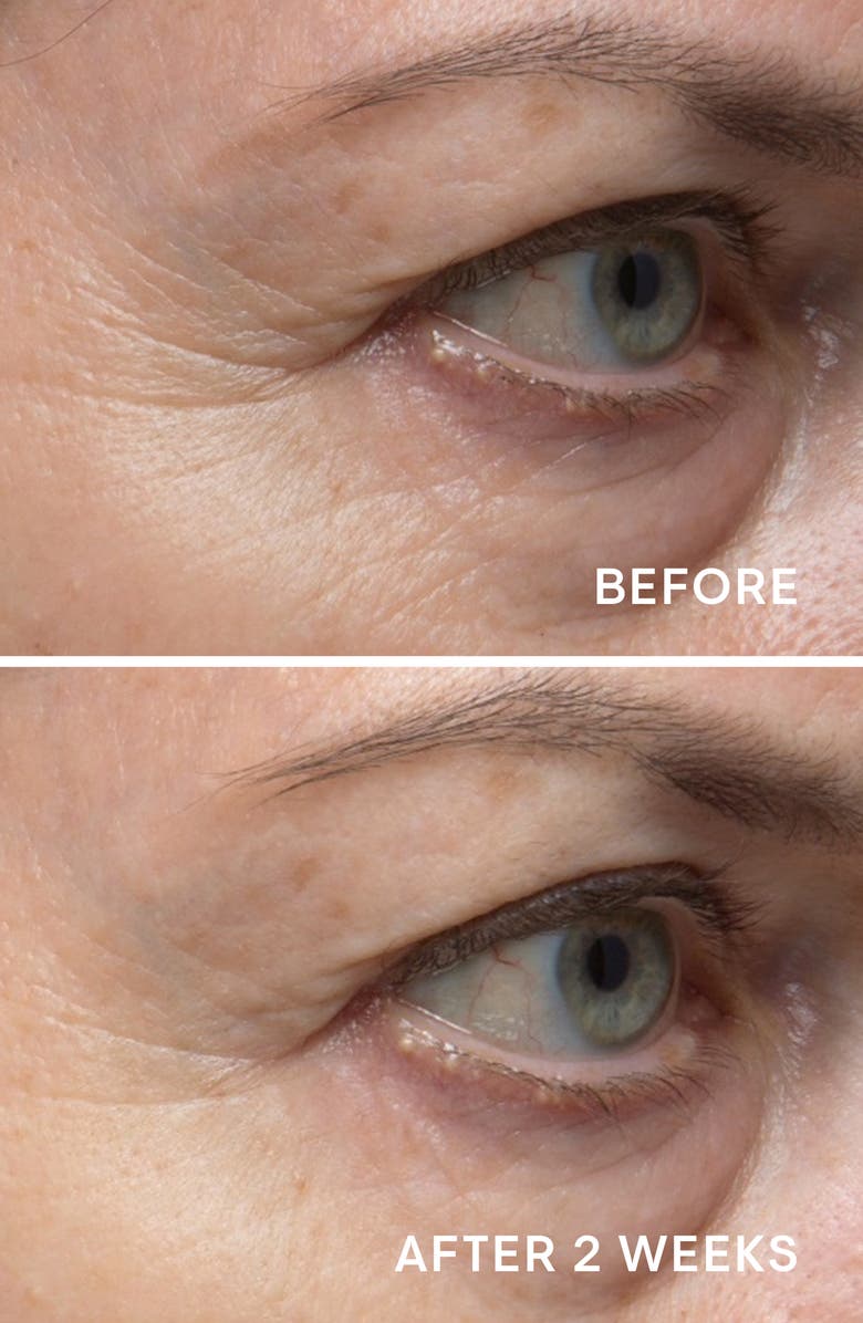 Elemis Pro-Collagen Eye Revive Mask, Alternate, color,