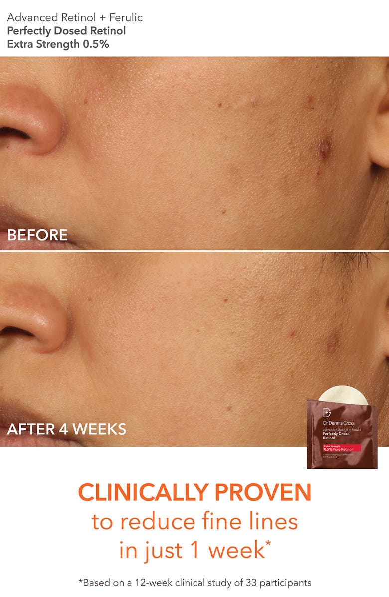 Dr. Dennis Gross Skincare Bright & Tight Delights Skin Care Set, Alternate, color,