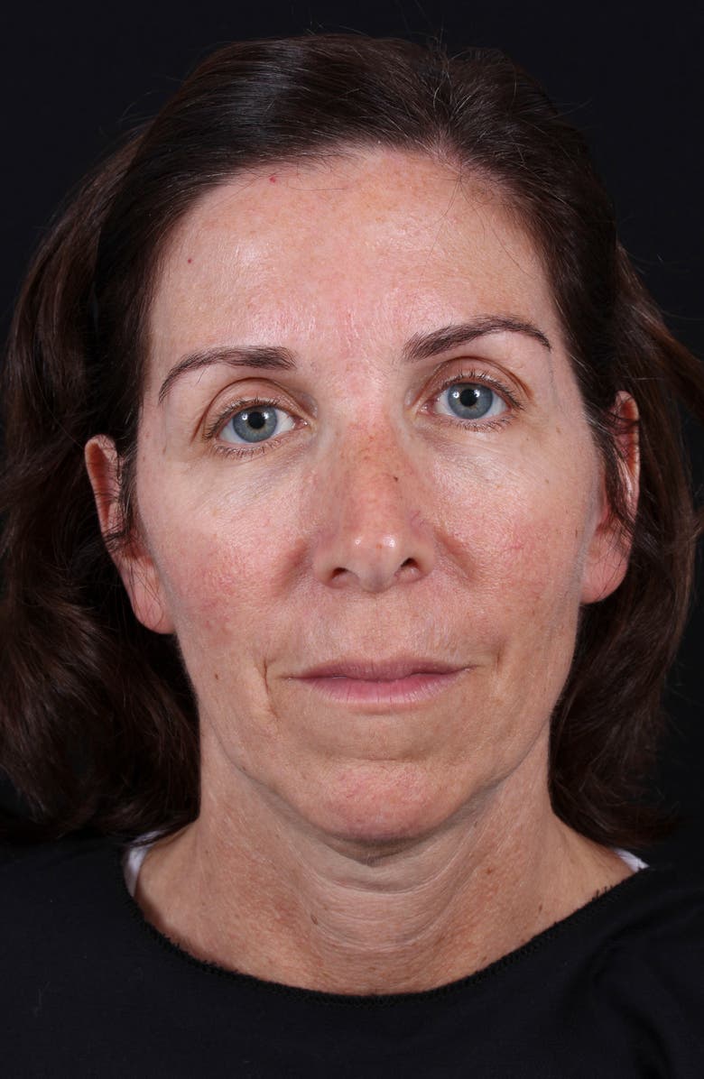 Colorescience <sup>®</sup> All Calm<sup>™</sup> Clinical Redness Corrector SPF 50 PA++++, Alternate, color,