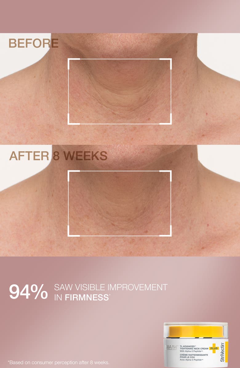 StriVectin<sup>®</sup> Skin Minis Skin Care Set $78 Value, Alternate, color, 