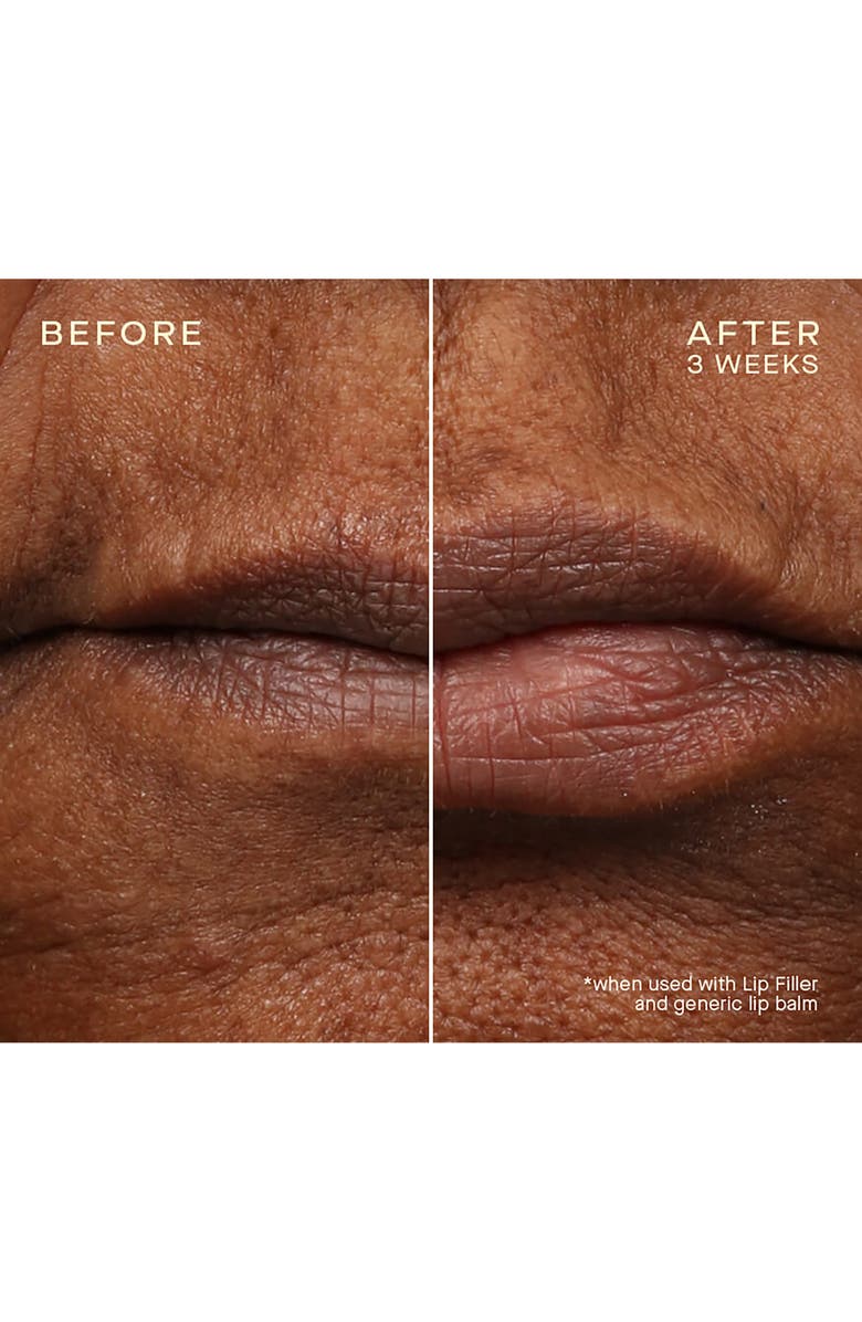 Ourself Lip Filler & Refill Cartridge Set, Alternate, color,