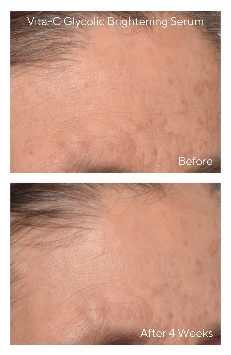 Murad<sup>®</sup> Murad Travel Size Brighten Skin Care Set USD $92 Value, Alternate, color, 