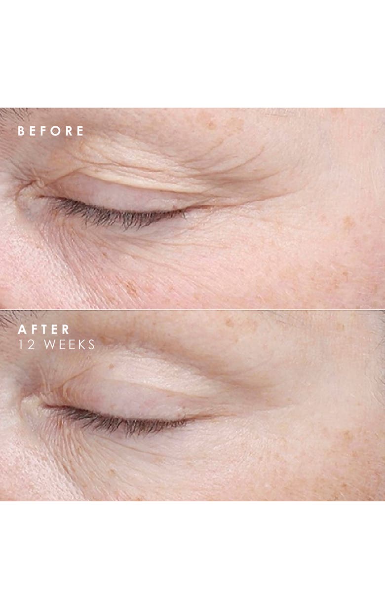 BIOEFFECT Imprinting Hydrogel Mask & EGF Face Serum Set, Alternate, color, 