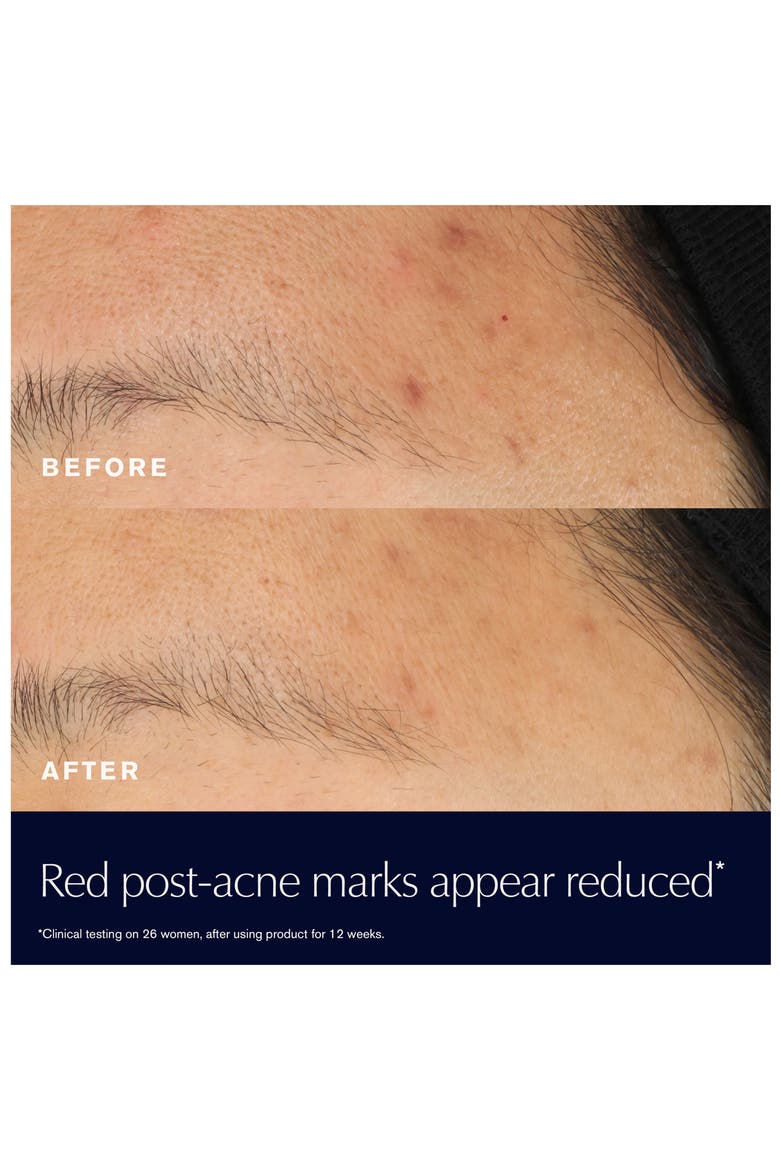 Advanced Night Repair Rescue Solution Face Serum with 15% Bifidus Ferment, Alternate, color, NO COLOR
