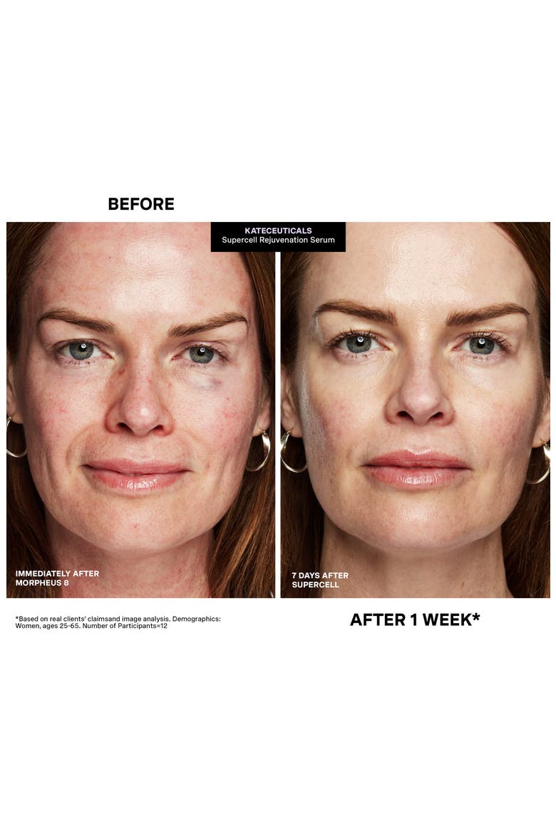 KateCeuticals SuperCell Rejvenation Serum, Alternate, color, NO COLOR