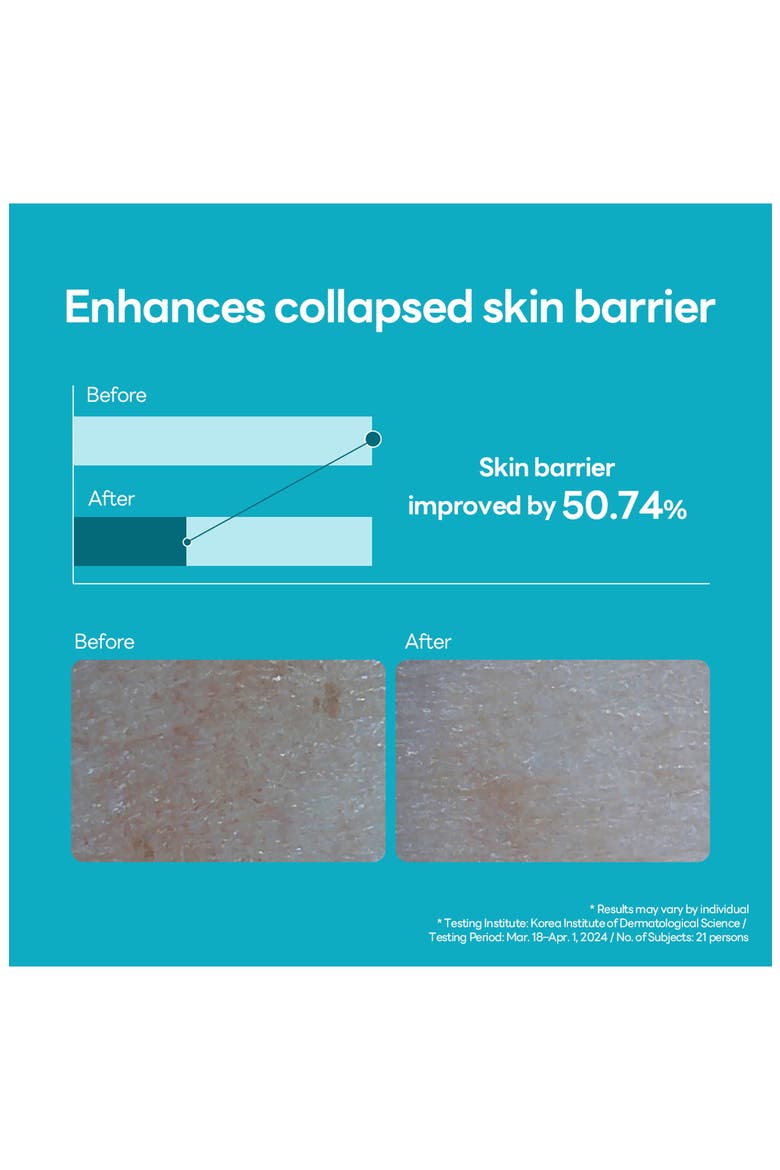 Madecassoside Blemish Repair Serum, Alternate, color, TURQUOISE/ AQUA