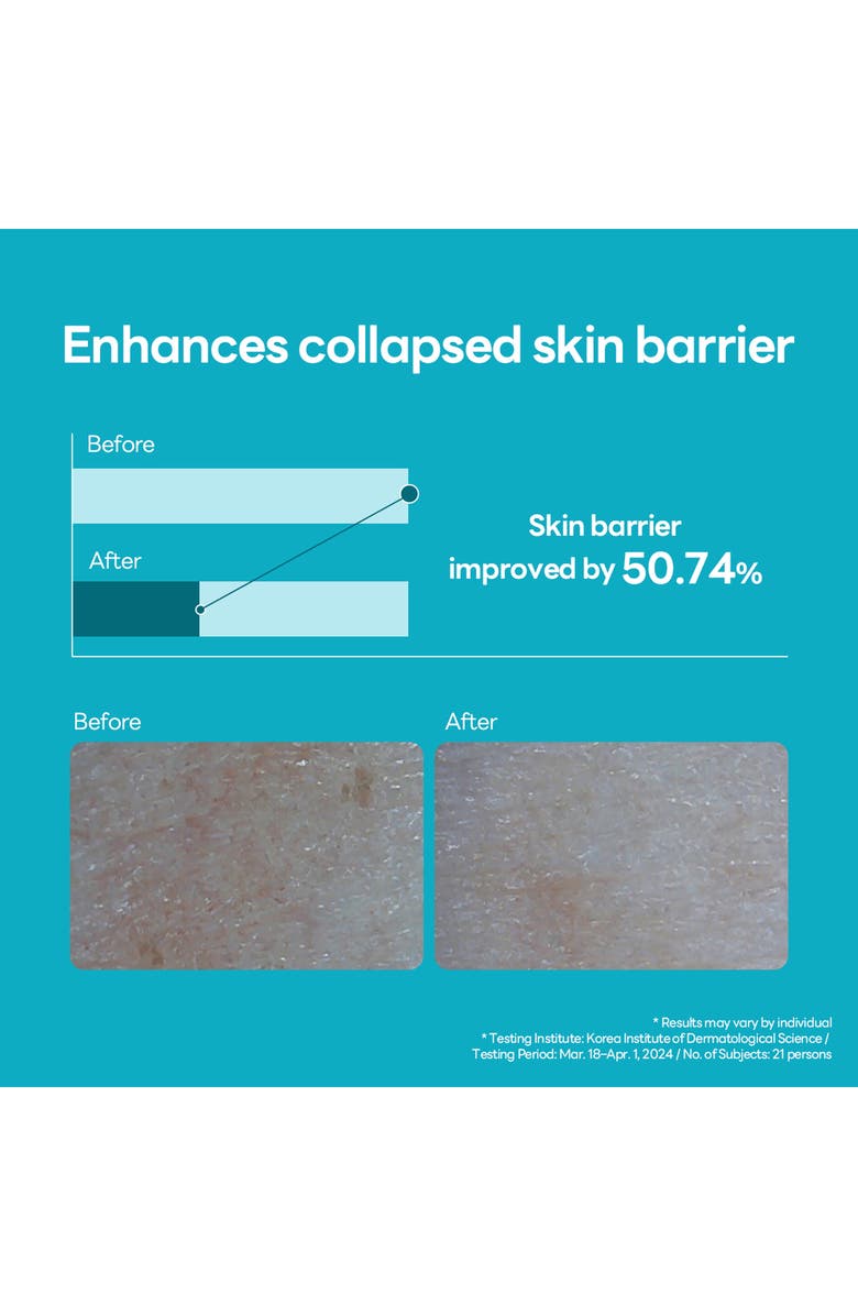 MEDIHEAL Madecassoside Blemish Repair Serum, Alternate, color, Turquoise/ Aqua