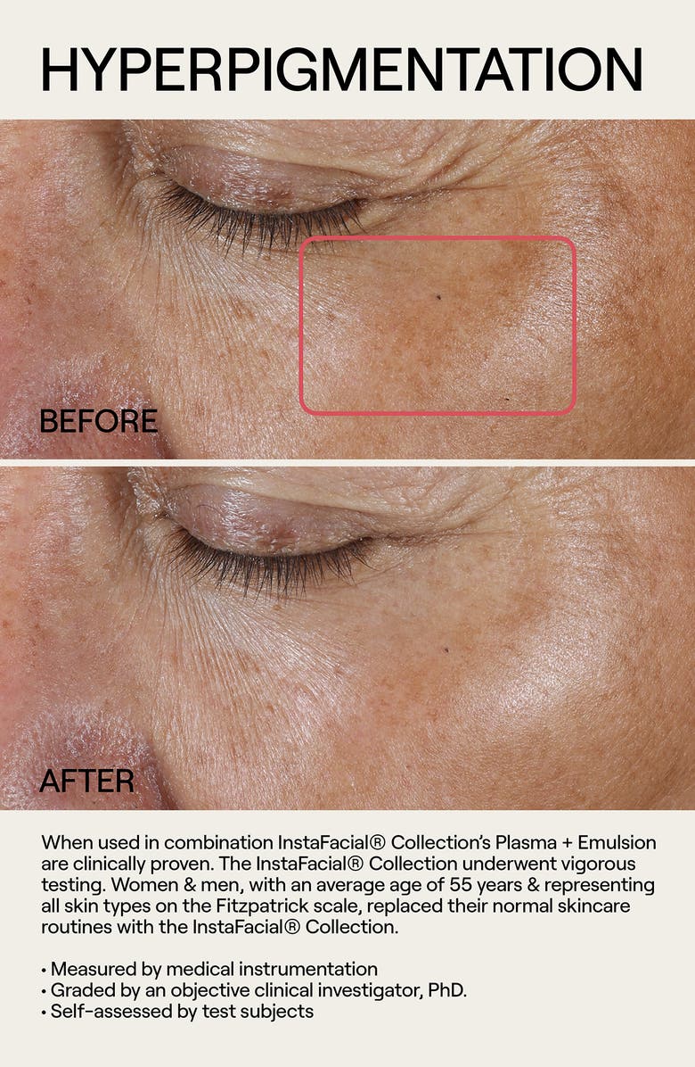 Dr. Diamond's Metacine InstaFacial<sup>®</sup> Emulsion Retinopro Growth Factor Night Cream, Alternate, color, 