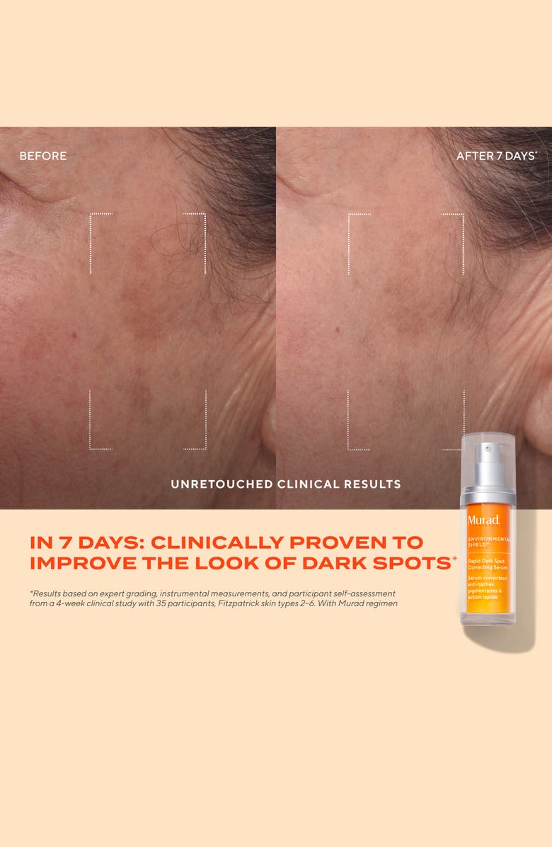 Murad<sup>®</sup> Rapid Dark Spot Correcting Serum, Alternate, color, 