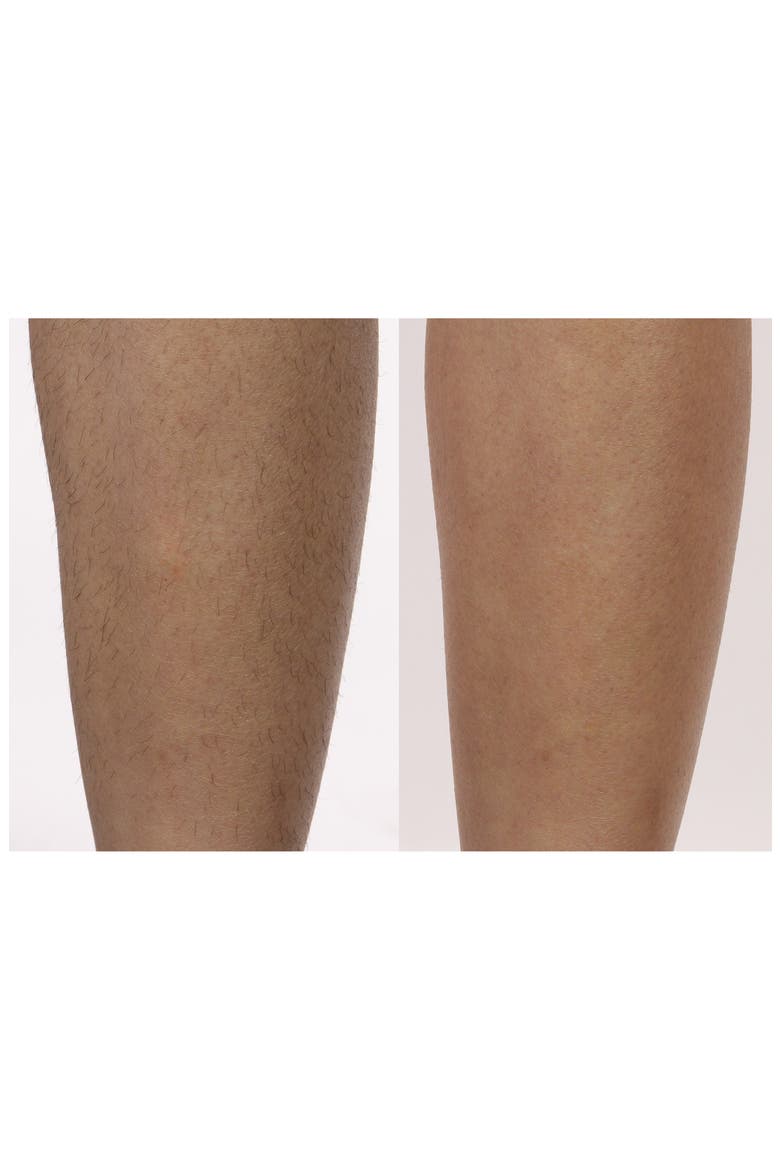 Flash & Go Express Hair Removal Device, Alternate, color, NO COLOR