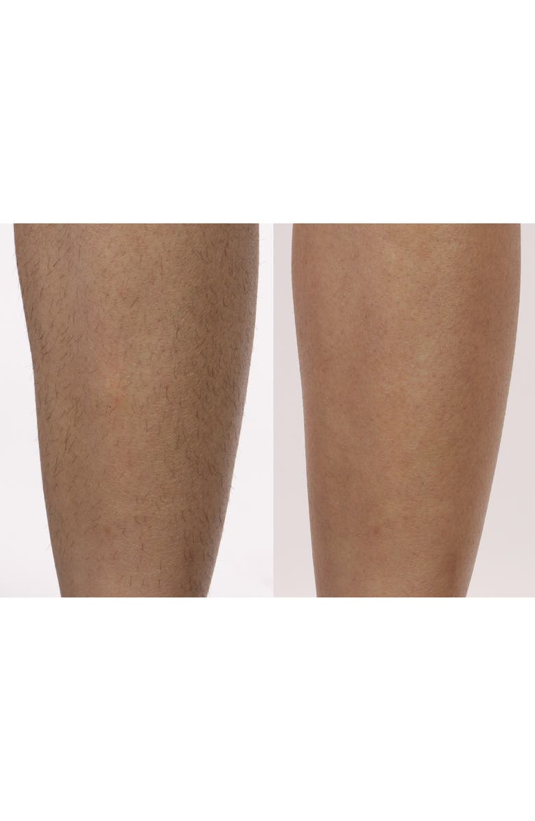 Silk'n Flash & Go Express Hair Removal Device, Alternate, color,