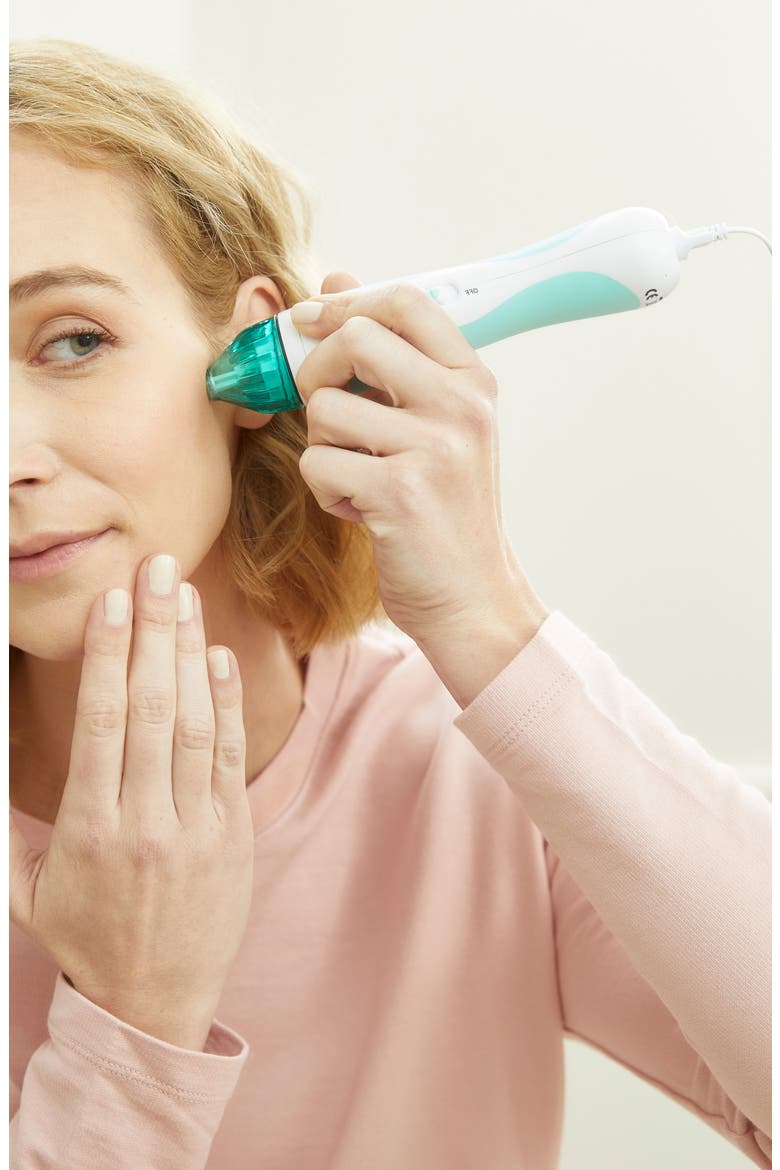 Classic Personal Microderm Device, Alternate, color, TEAL