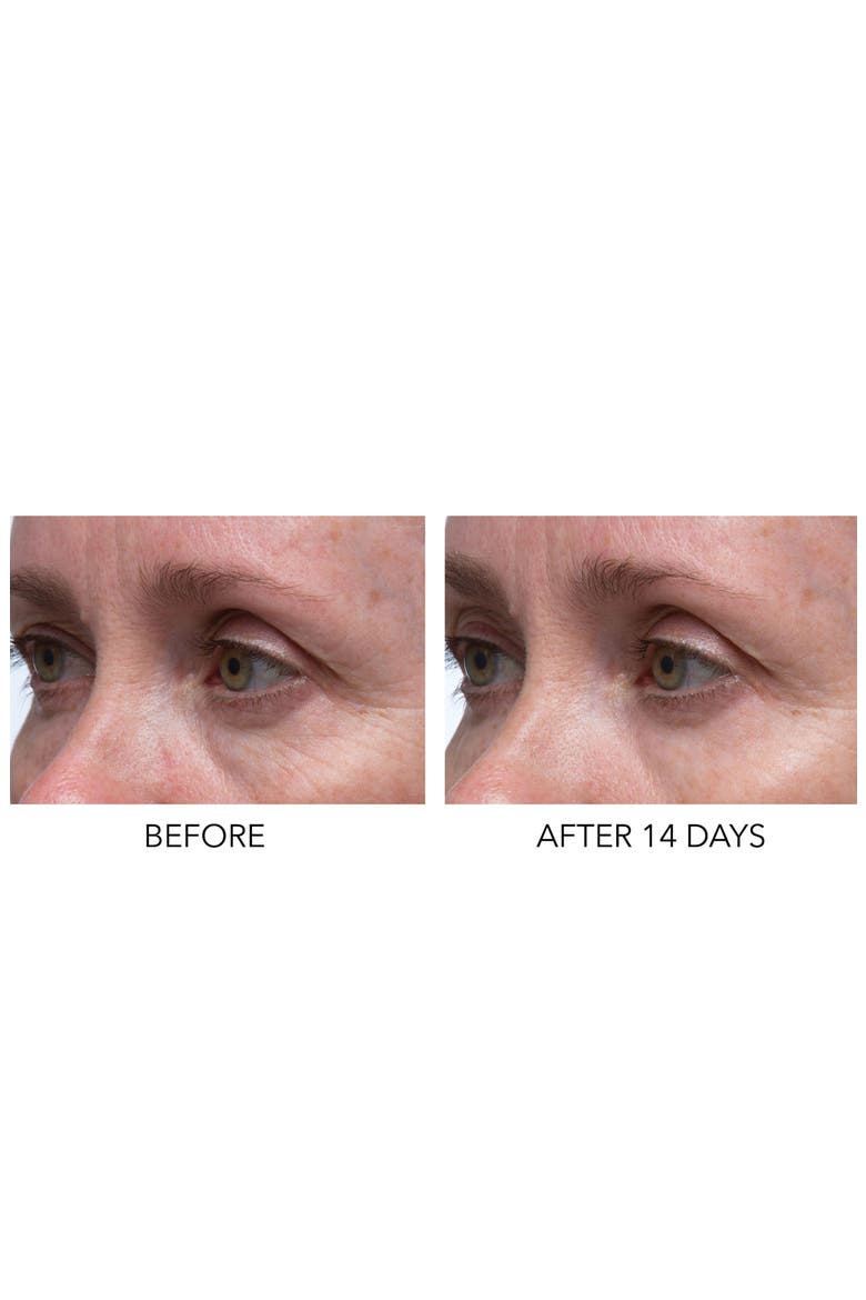 Hyaluronic Marine Dew It Right Eye Gel, Alternate, color, NO COLOR
