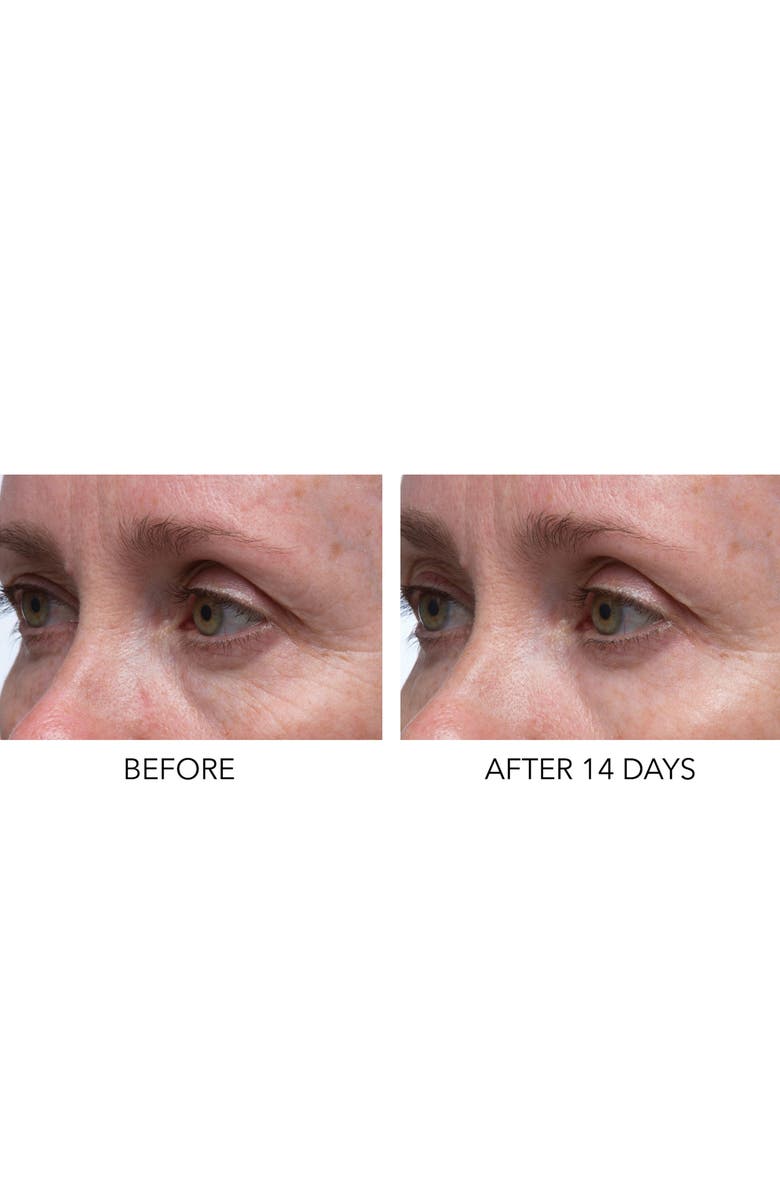 Dr. Dennis Gross Skincare Hyaluronic Marine Dew It Right Eye Gel, Alternate, color,