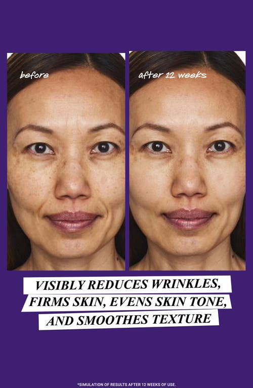 Kiehl's Since 1851 Retinol Skin-renewing Daily Micro-dose Facial Serum In Transparent