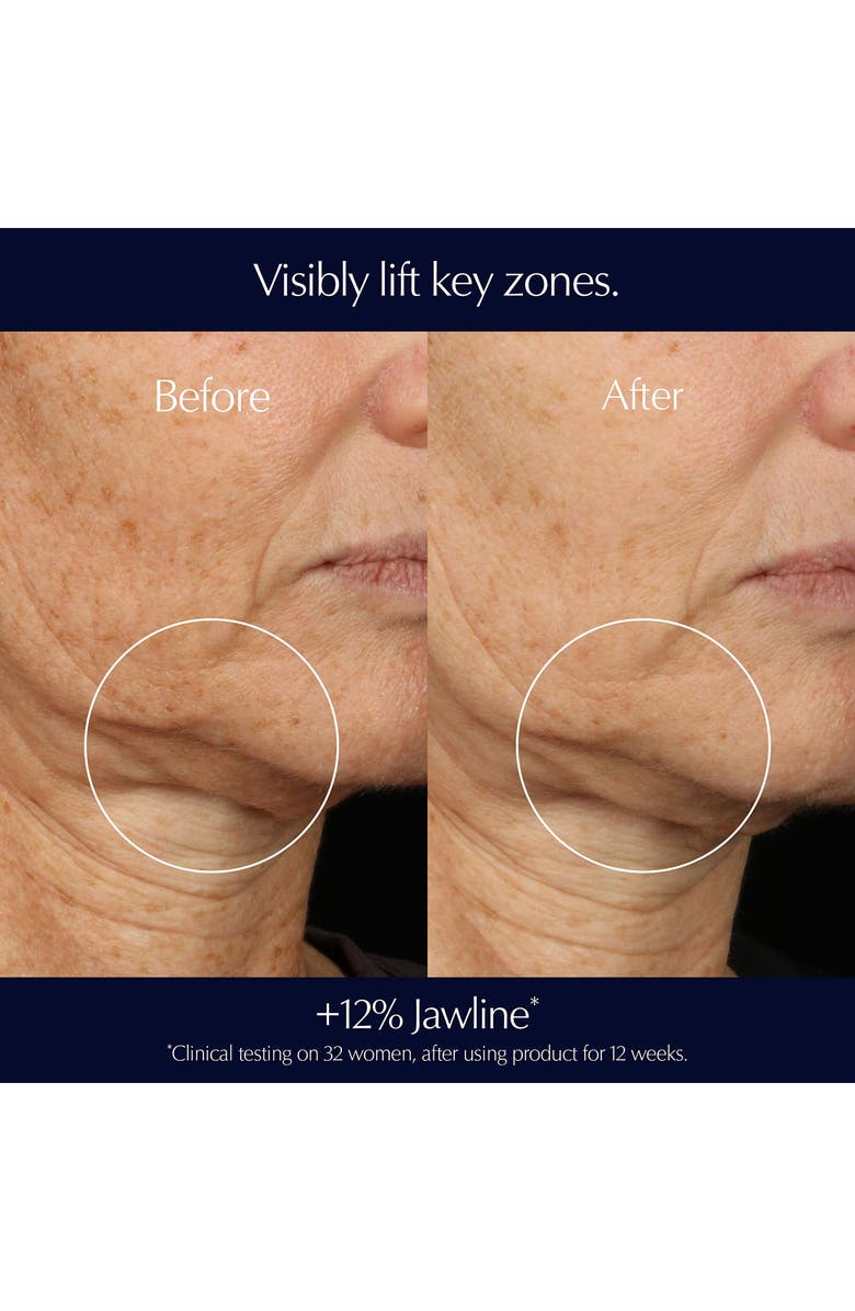 Estée Lauder Perfectionist Pro Rapid Firm + Lift Serum with Hexapeptides, Alternate, color,