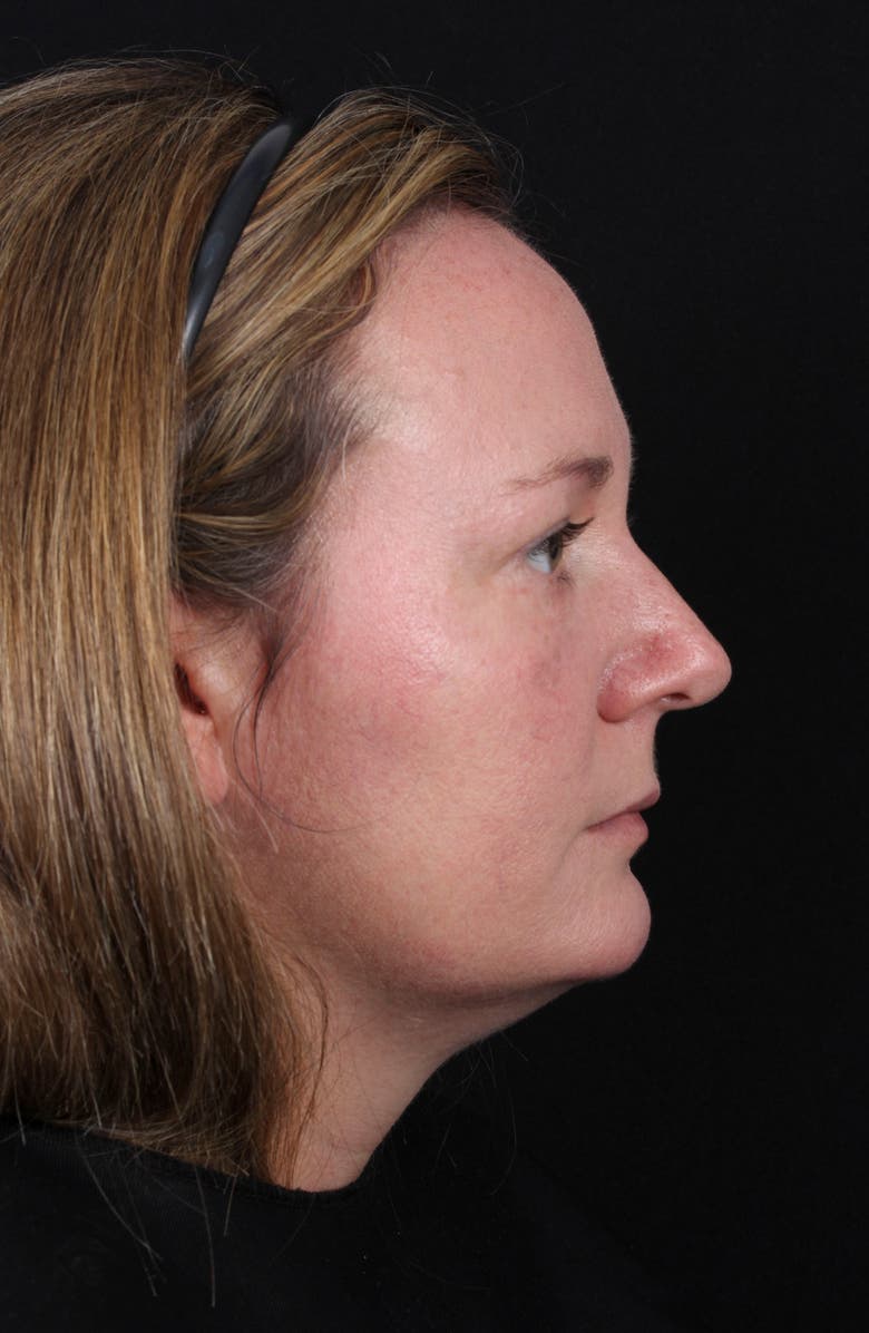 Colorescience <sup>®</sup> All Calm<sup>™</sup> Clinical Redness Corrector SPF 50 PA++++, Alternate, color,