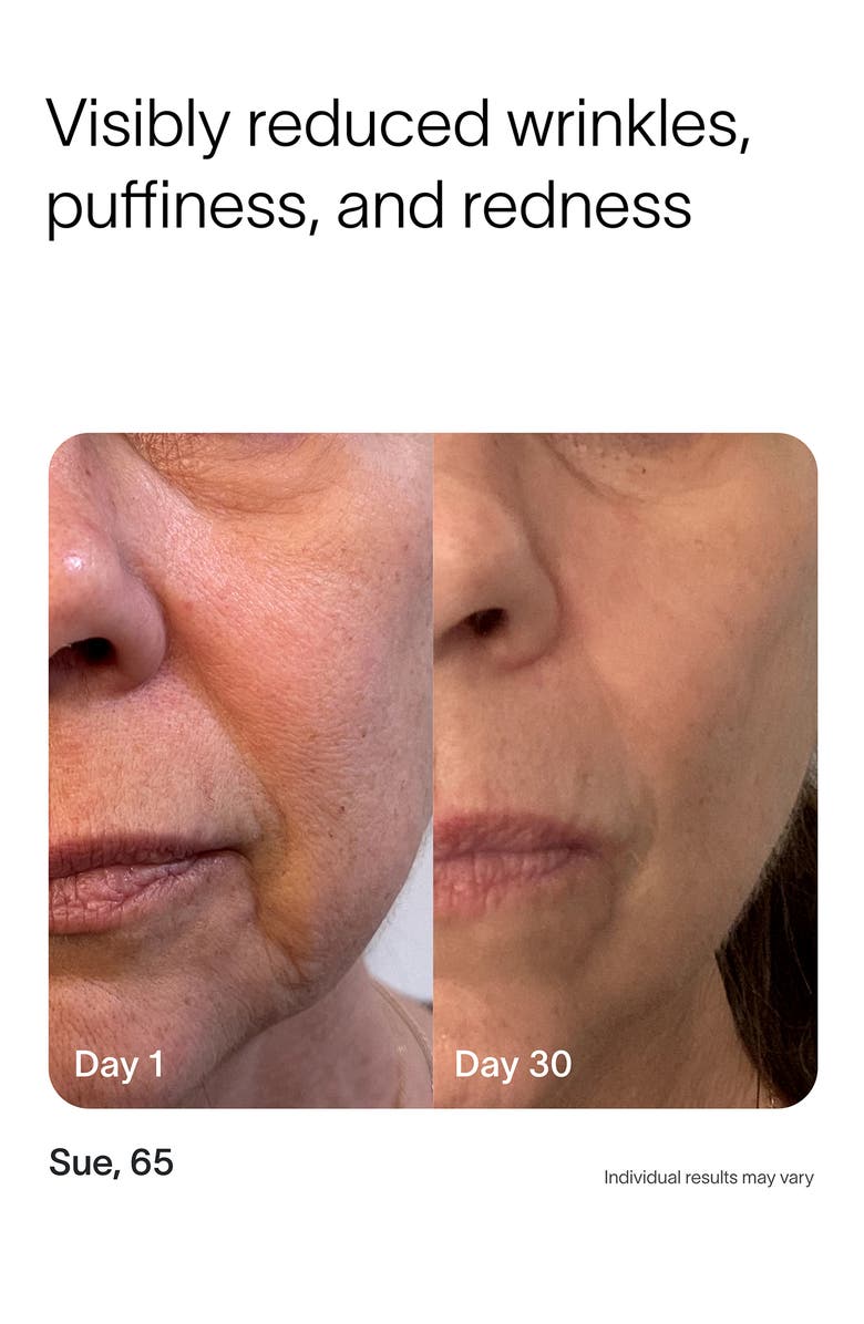 SolaWave 4-in-1 Skin Care Wand, Alternate, color, Charcoal