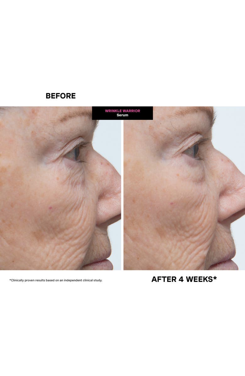 Kate Somerville<sup>®</sup> Wrinkle Warrior<sup>®</sup> 2-in-1 Plumping Moisturizer + Serum, Alternate, color,