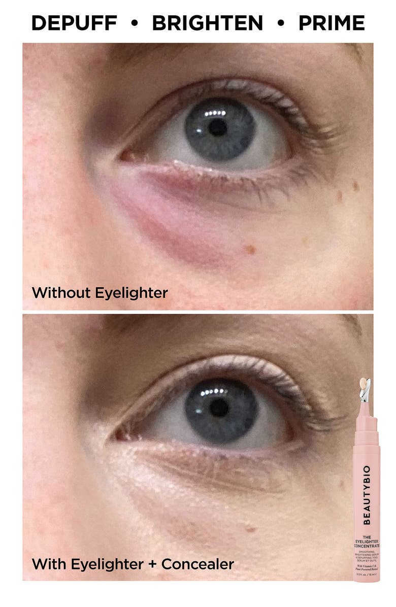 BeautyBio Showstopping Skin Set (Limited Edition) $326 Value, Alternate, color,