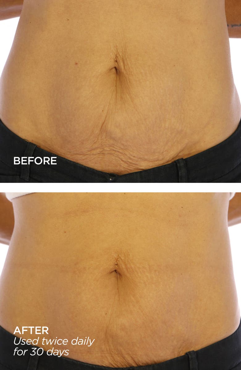 BeautyBio GloPRO<sup>®</sup> BODY MicroTip<sup>™</sup> Attachment Replacement Head, Alternate, color, 