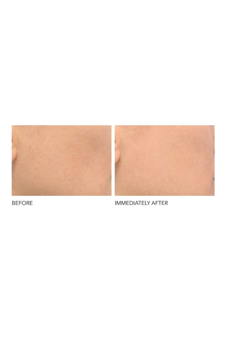 Clinical Grade Resurfacing Liquid Peel, Alternate, color, NO COLOR