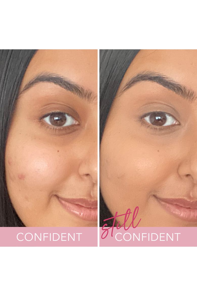 Doll Skin Anti-Stress Skin Perfecting Concealer, Alternate, color, Medium