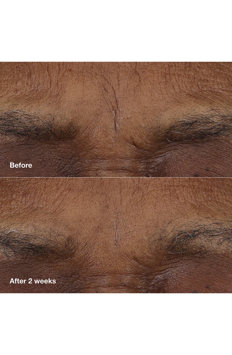 Clinique Smart Clinical Repair AM/PM Retinoid Balm, Alternate, color,