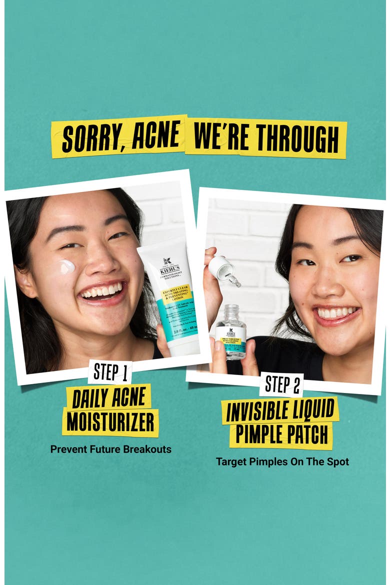 Expertly Clear Acne-Treating & Preventing Lotion, Alternate, color, NO COLOR