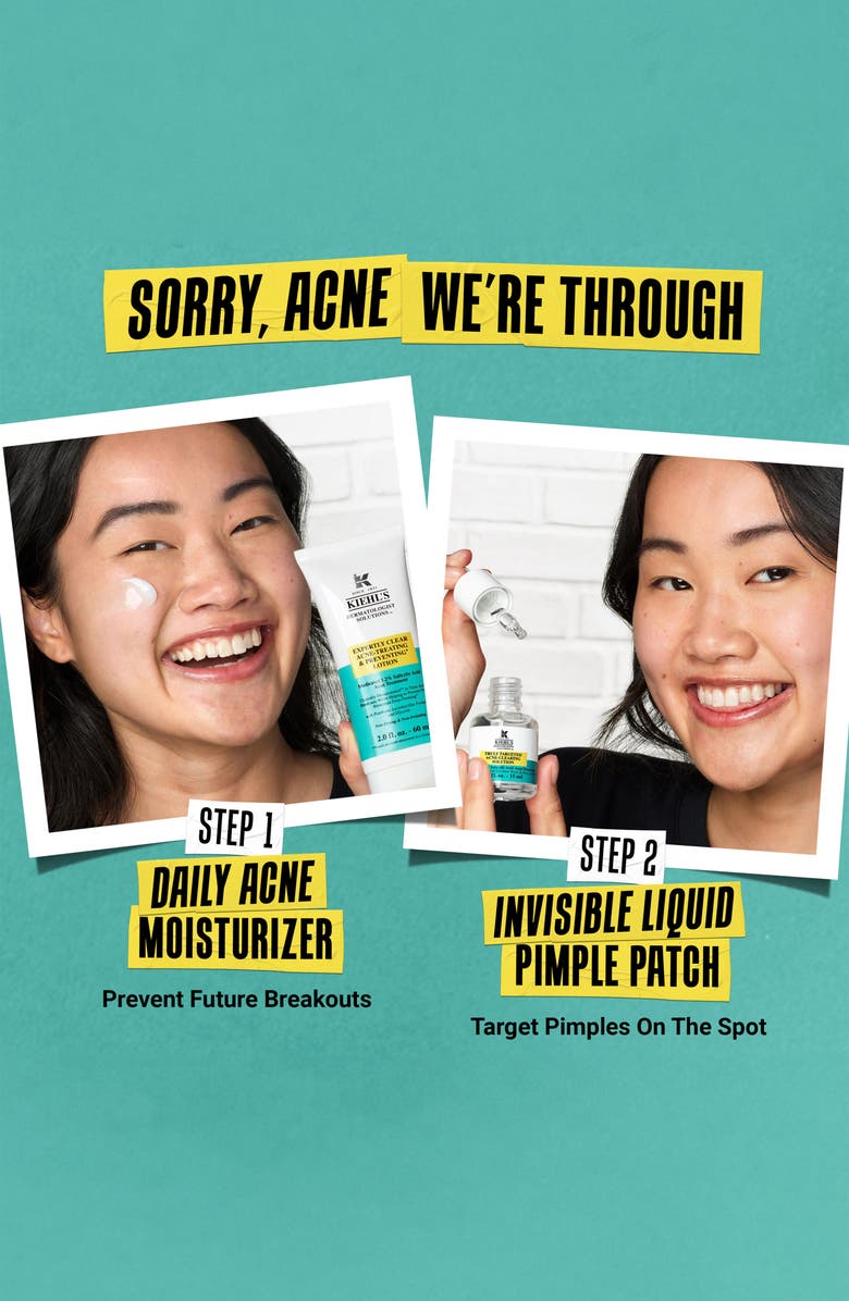 Kiehl's Since 1851 Expertly Clear Acne-Treating & Preventing Lotion, Alternate, color, 
