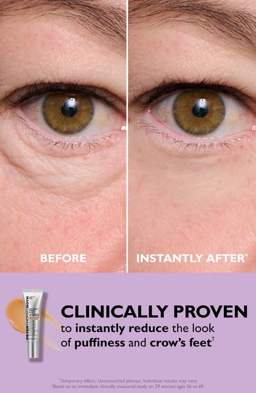 Peter Thomas Roth Instant Firmx Eye Temporary Eye Tightener Easy-wear Formula For Firming Under-eye Bags & Wrinkles 0. In Transparent