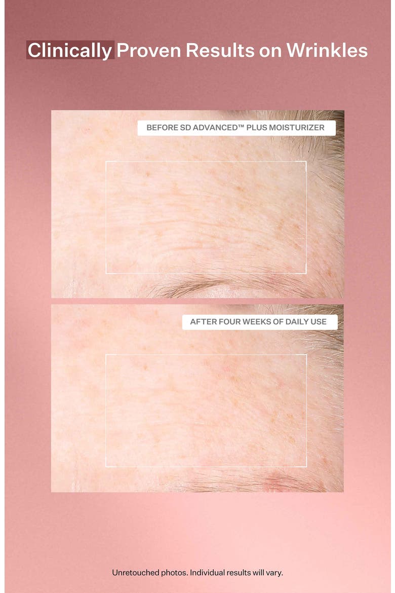 SD Advanced™ Plus Intensive Moisturizer, Alternate, color, NO COLOR