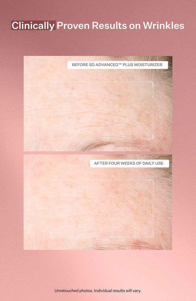 StriVectin<sup>®</sup> SD Advanced<sup>™</sup> Plus Intensive Moisturizer, Alternate, color, 