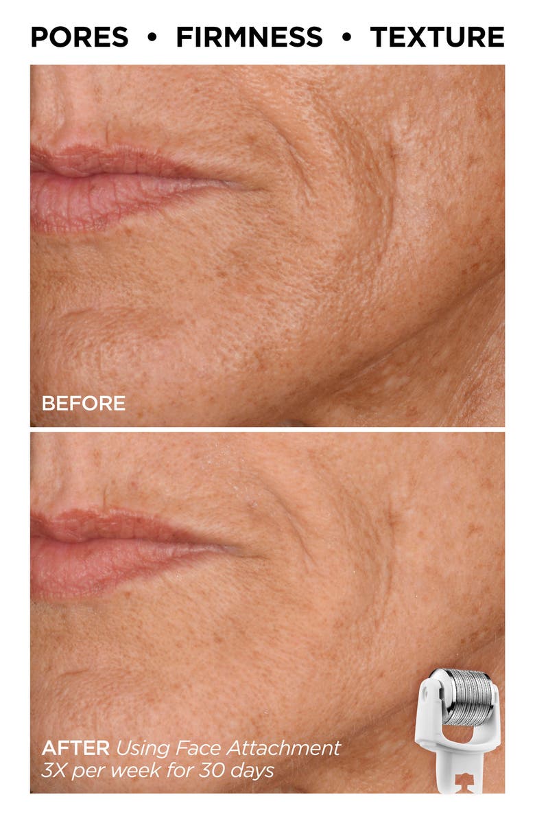 BeautyBio The Complete GloPRO<sup>®</sup> Set USD $422 Value, Alternate, color,