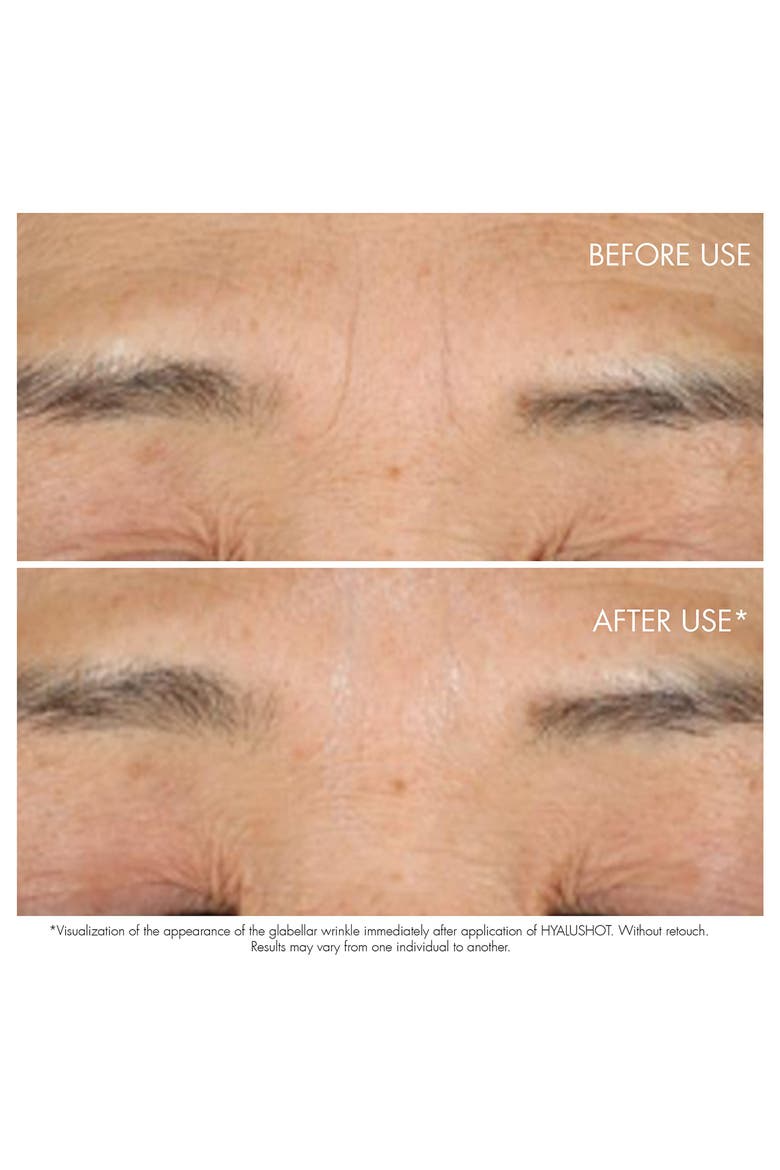 Capture Totale Hyalushot: Wrinkle Corrector with Hyaluronic Acid, Alternate, color, NO COLOR