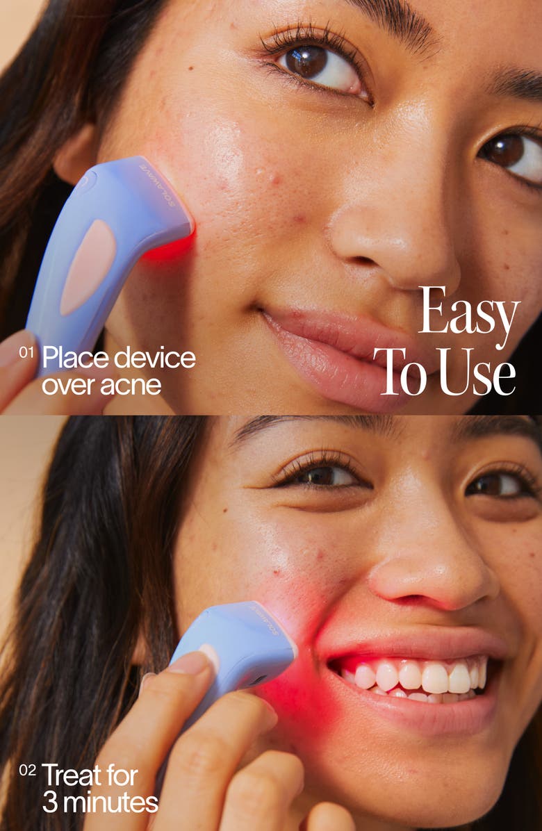 SolaWave 3 Minute Light Therapy Acne Spot Treatment, Alternate, color, Periwinkle