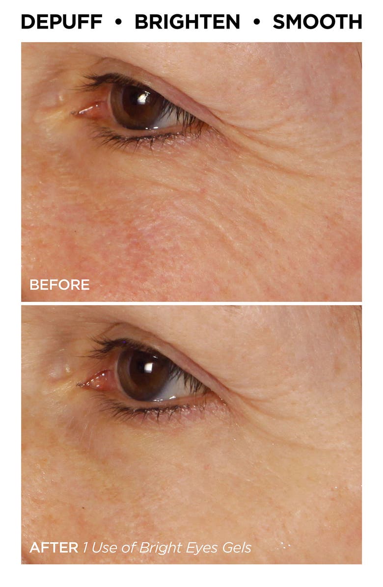 BeautyBio Bright Eyes Illuminating Colloidal Silver + Collagen Eye Patch Party Pack (Nordstrom Exclusive) $120 Value, Alternate, color, 