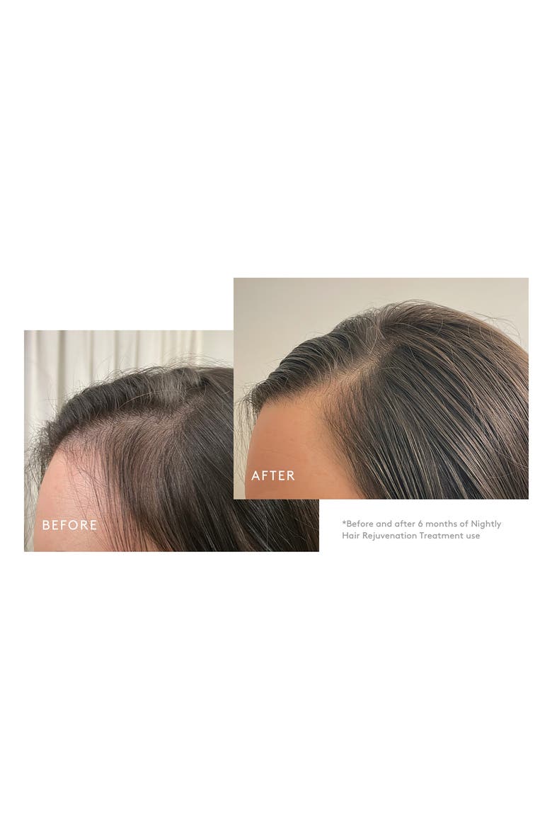Flourish® Nightly Intensive Hair Rejuvenation Treatment, Alternate, color, 90 DAY