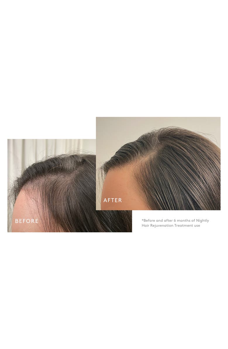 Virtue<sup>®</sup> Flourish<sup>®</sup> Nightly Intensive Hair Rejuvenation Treatment, Alternate, color,