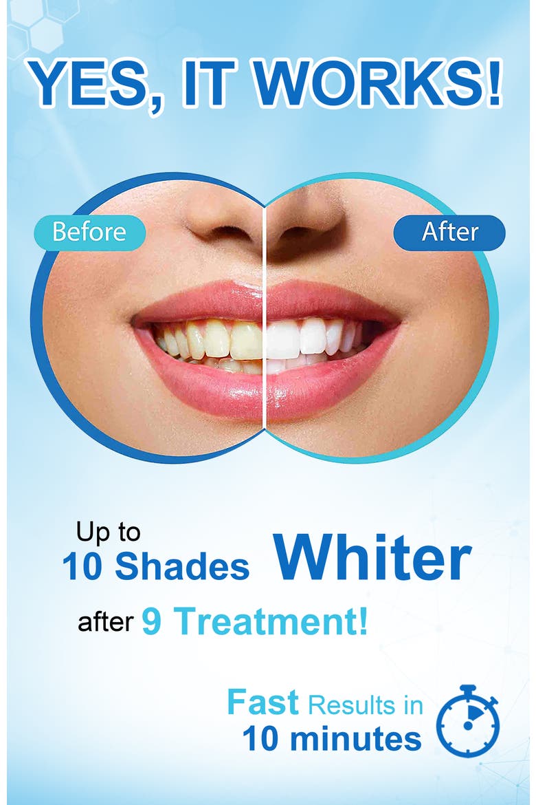 Teeth Whitening Pen Kit 14 Treatments - Non-Sensitive Teeth Whitening Gel Pen, Alternate, color, Silver