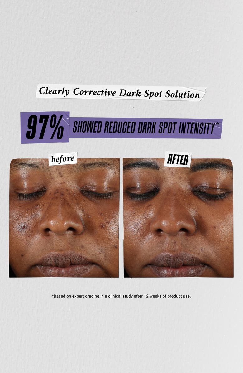 Kiehl's Since 1851 Brighten Up Babes Gift Set $104 Value, Alternate, color,