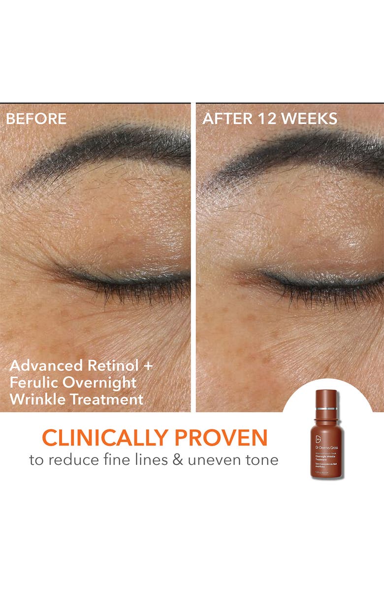 Dr. Dennis Gross Skincare AM/PM Gold Standard Kit (Limited Edition) USD $184 Value, Alternate, color, 