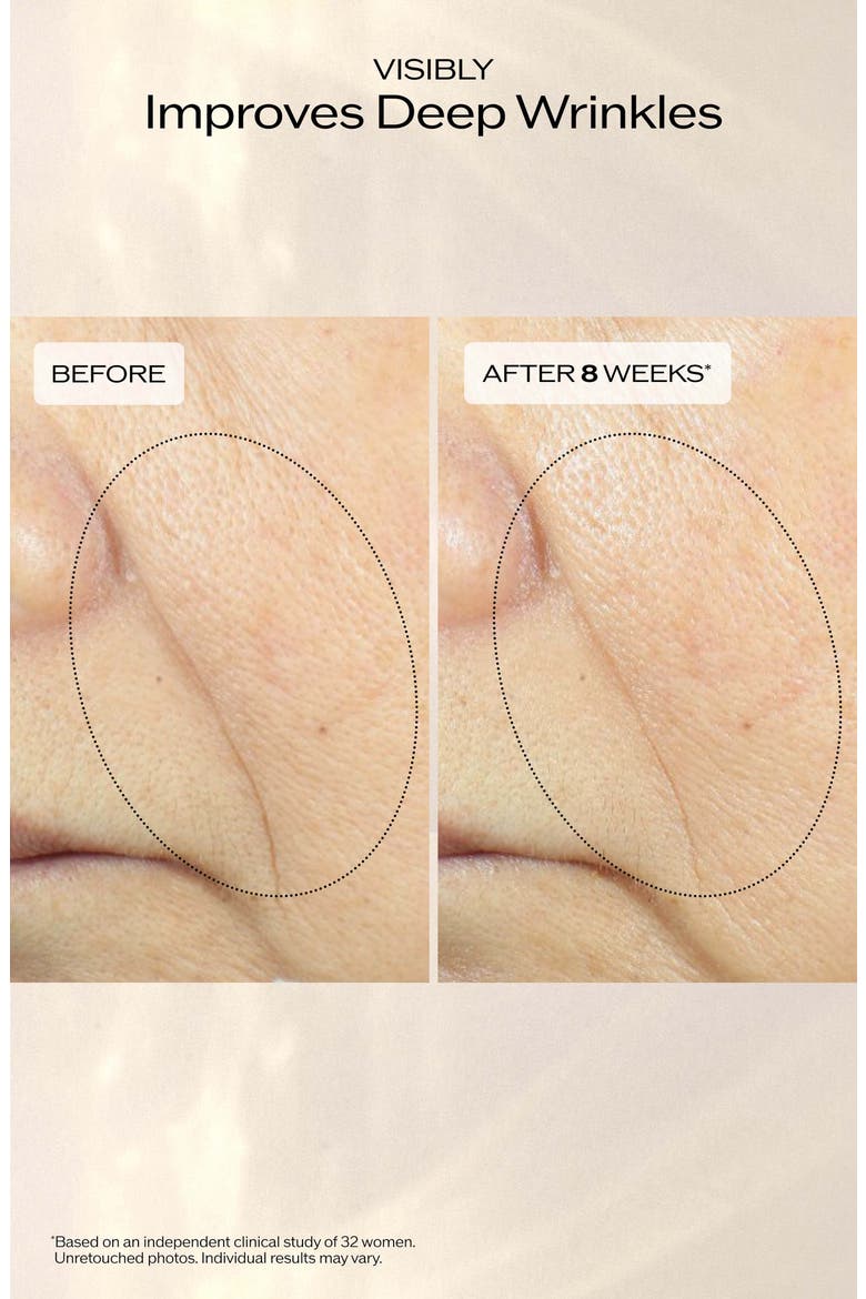 Vital Perfection Advanced Lifting & Firming Cream Gift Set $227 Value, Alternate, color, NO COLOR