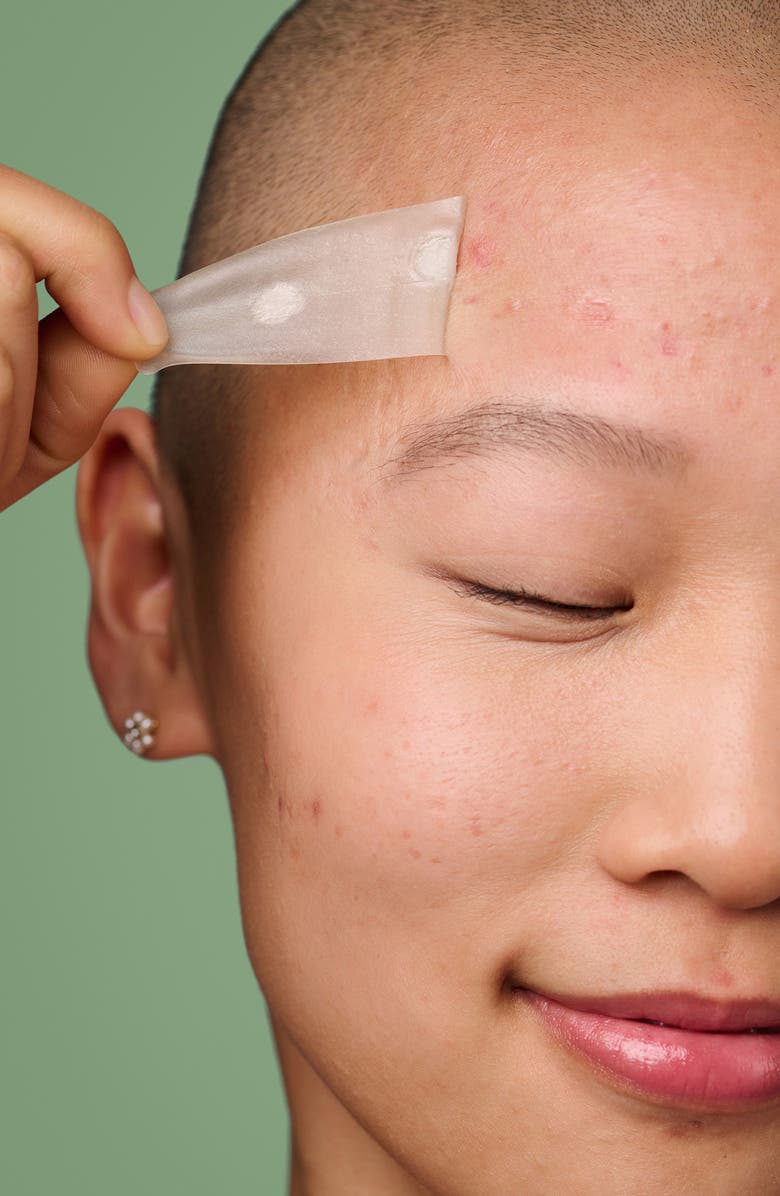 Hero Mighty Patch<sup>™</sup> Surface Patch, Alternate, color,