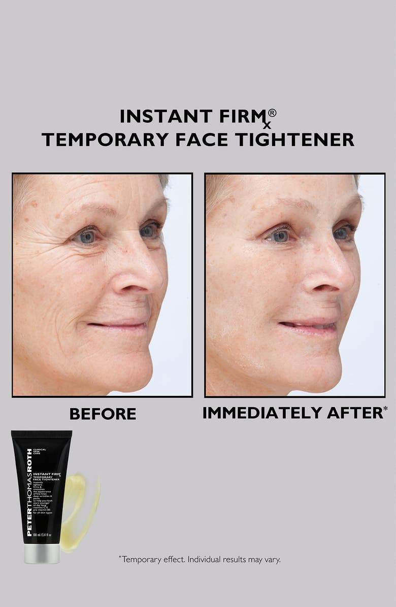 Peter Thomas Roth Instant Firmx<sup>®</sup> 2-Piece Set, Alternate, color, 