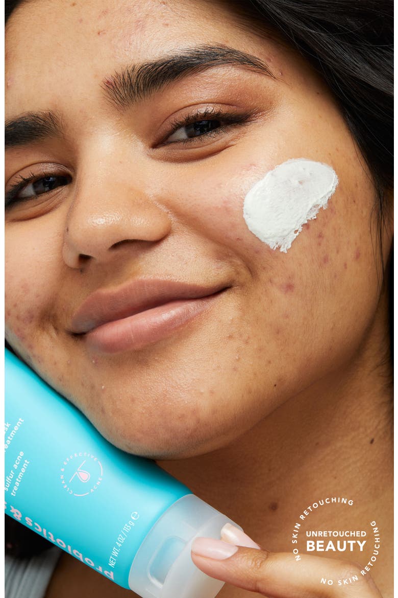 Acne All-Star 3-in-1 Acne Cleanser, Mask & Spot Treatment, Alternate, color, NO COLOR