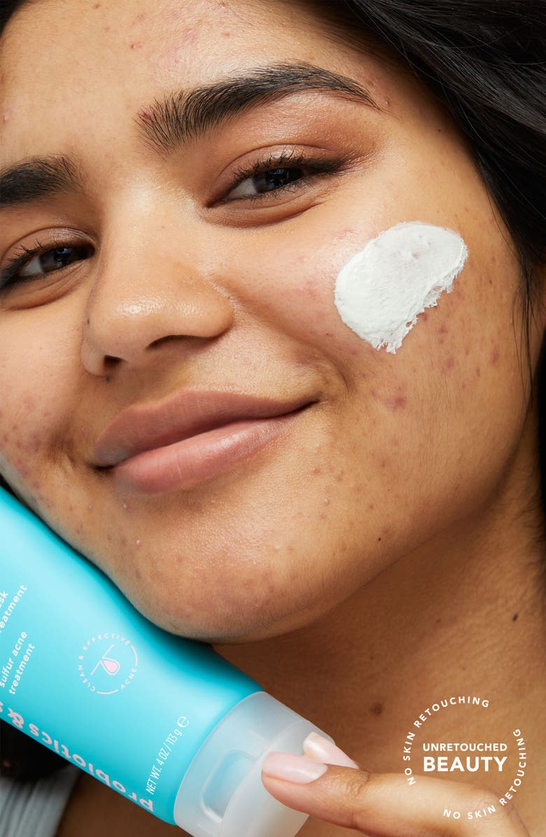 TULA Skincare Acne All-Star 3-in-1 Acne Cleanser, Mask & Spot Treatment, Alternate, color, 