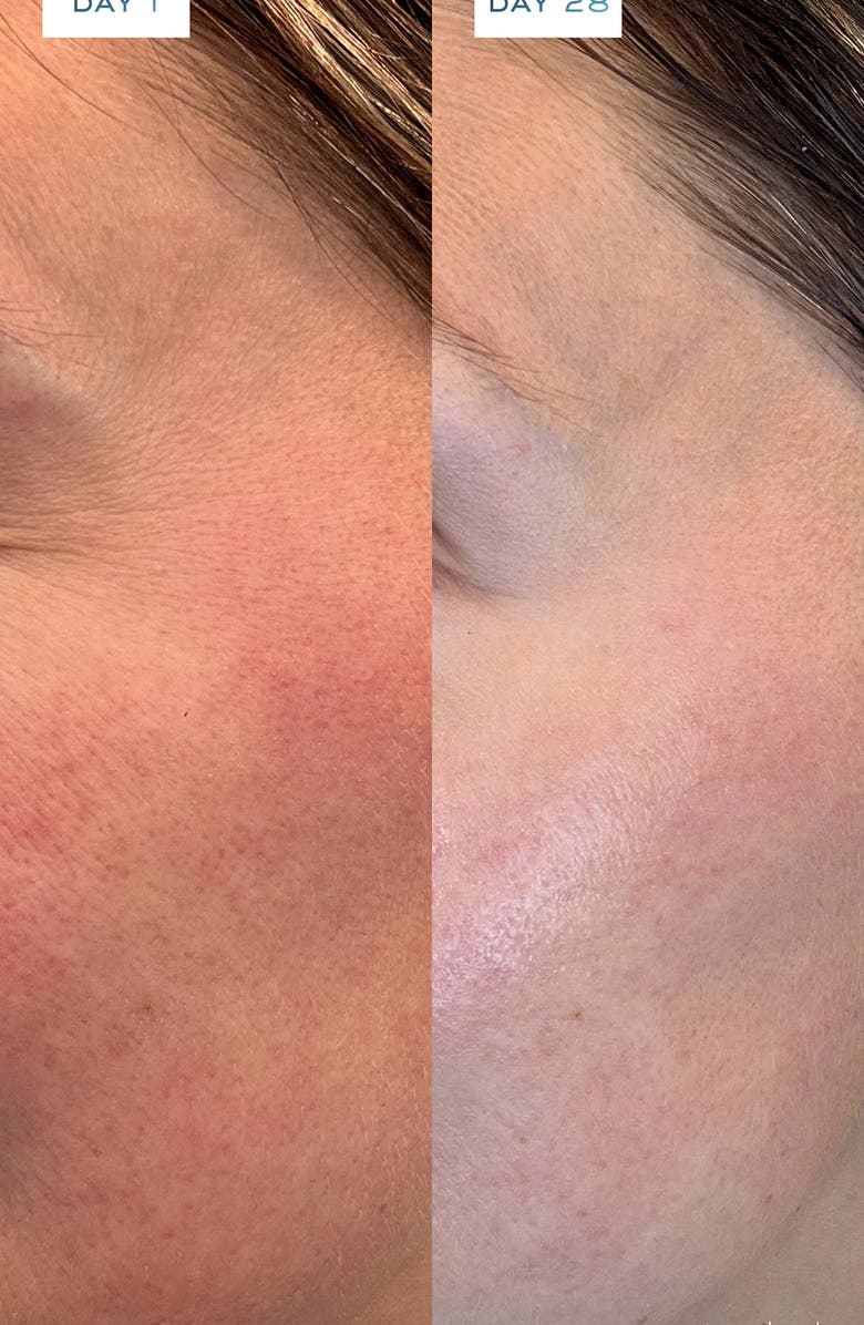 Element Eight O2 Eight Active Discovery Duo, Alternate, color,