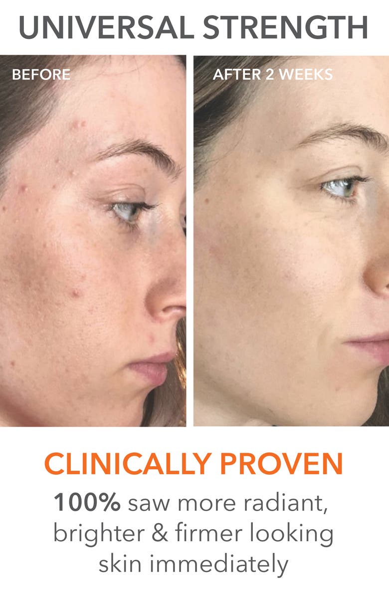 Dr. Dennis Gross Skincare The Glow Up Set $257 Value, Alternate, color,