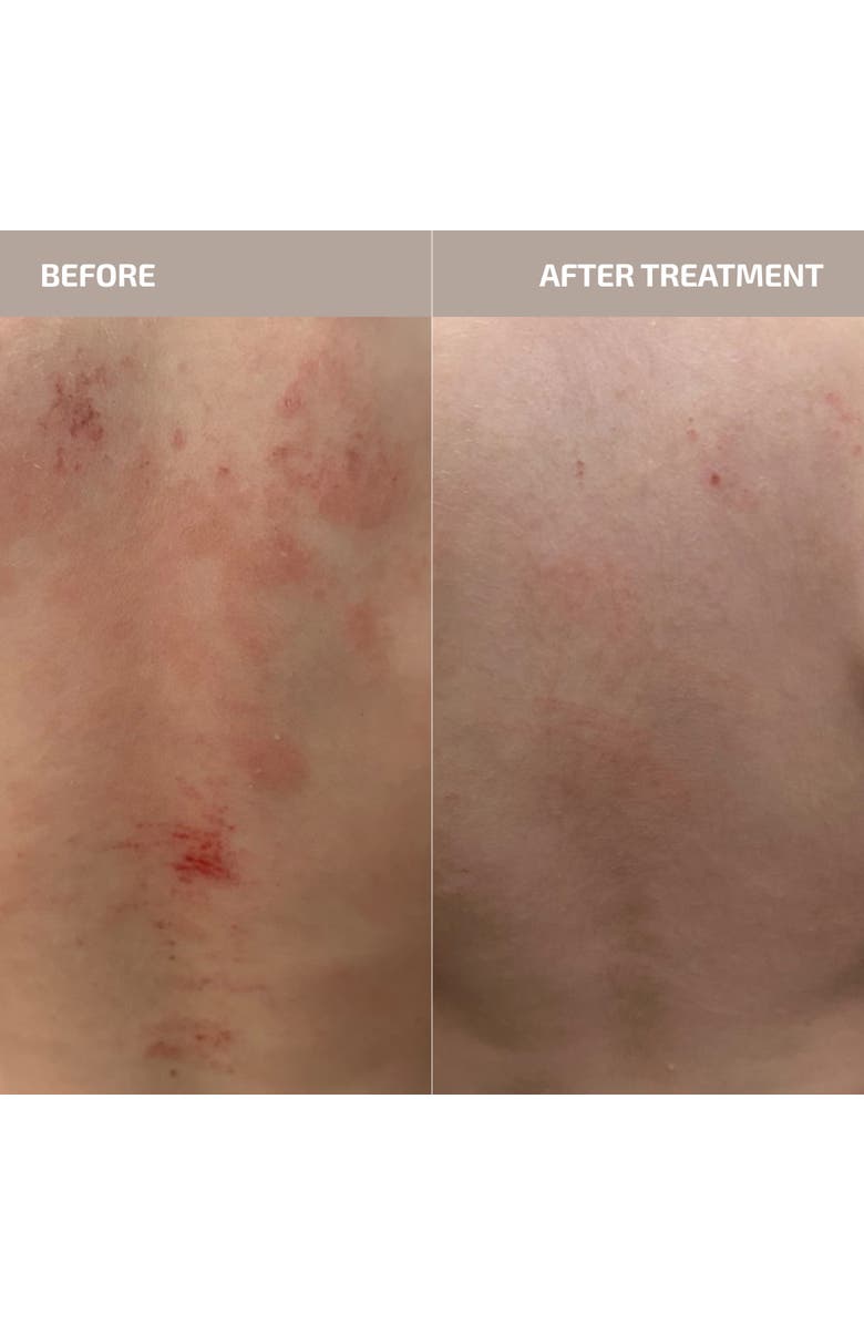 Codex Labs ANTÜ Skin Barrier Support Supplement, Alternate, color, Light Red